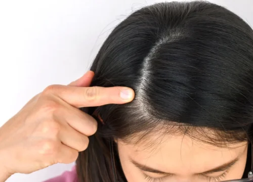 The Everyday Effects of Water Quality on Your Skin, Hair, and Home